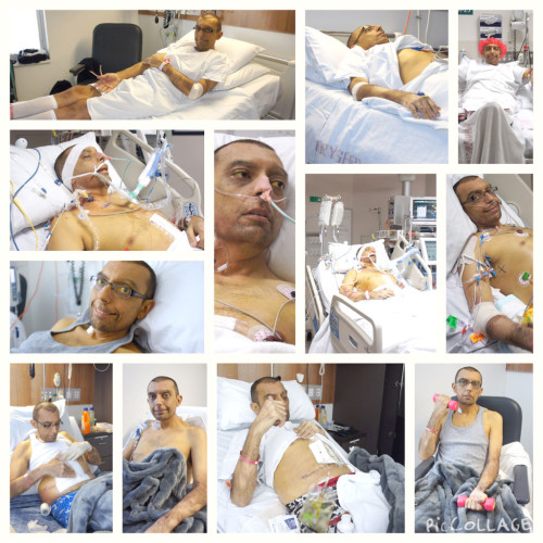 Liver-transplant-collage